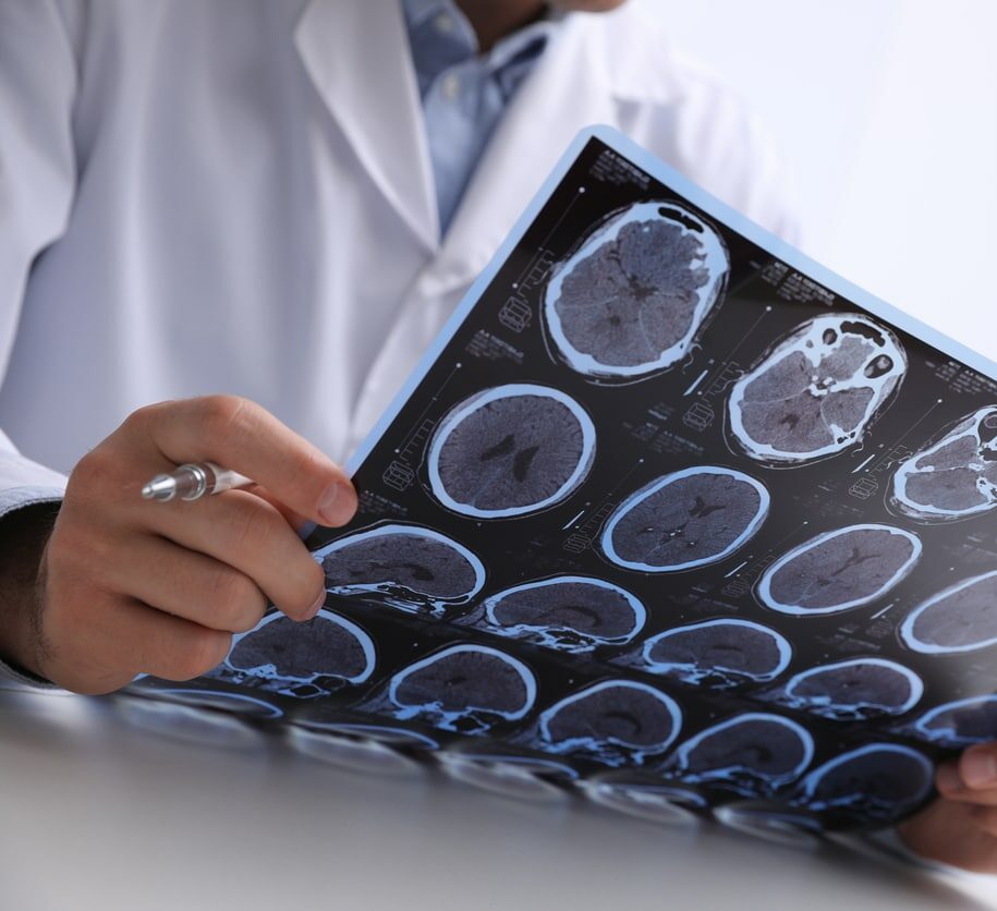 Doctor examining MRI images of patient with multiple sclerosis at table in clinic, closeup