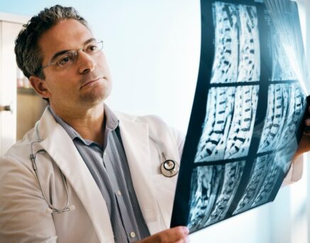 Doctor looking at MRI of spinal cord.